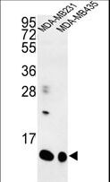 CORNIFIN / SPRR1B Antibody - Western blot of SPRR1B Antibody in MDA-MB231, MDA-MB435 cell line lysates (35 ug/lane). SPRR1B (arrow) was detected using the purified antibody.