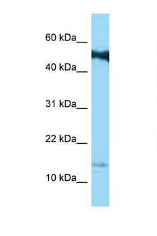 CORNIFIN / SPRR1B Antibody - SPRR1B antibody Western blot of Jurkat Cell lysate. Antibody concentration 1 ug/ml.  This image was taken for the unconjugated form of this product. Other forms have not been tested.