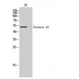 CORO1A / Coronin 1a Antibody - Western blot of Coronin 1A antibody