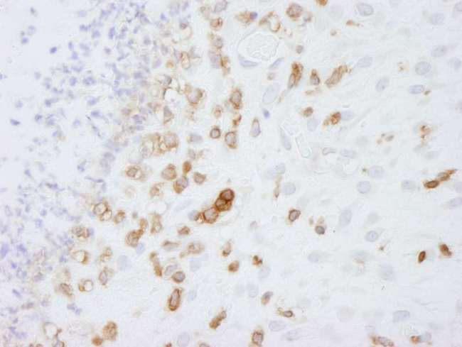 CORO1A / Coronin 1a Antibody - Detection of Mouse Coronin 1 by Immunohistochemistry. Sample: FFPE section of mouse fibroma. Antibody: Affinity purified rabbit anti-Coronin 1 used at a dilution of 1:250.