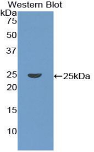 CORO1A / Coronin 1a Antibody - Western blot of recombinant CORO1A / p57.  This image was taken for the unconjugated form of this product. Other forms have not been tested.