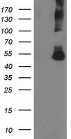 CORO1A / Coronin 1a Antibody - HEK293T cells were transfected with the pCMV6-ENTRY control (Left lane) or pCMV6-ENTRY CORO1A (Right lane) cDNA for 48 hrs and lysed. Equivalent amounts of cell lysates (5 ug per lane) were separated by SDS-PAGE and immunoblotted with anti-CORO1A.
