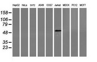 CORO1A / Coronin 1a Antibody - Western blot of extracts (35 ug) from 9 different cell lines by using anti-CORO1A monoclonal antibody.