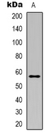 CORO1A / Coronin 1a Antibody - Western blot analysis of Clipin A expression in Jurkat (A) whole cell lysates.