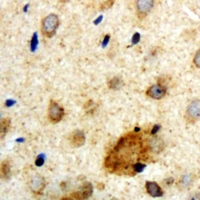CORO1A / Coronin 1a Antibody - Immunohistochemical analysis of Clipin A staining in human brain formalin fixed paraffin embedded tissue section. The section was pre-treated using heat mediated antigen retrieval with sodium citrate buffer (pH 6.0). The section was then incubated with the antibody at room temperature and detected with HRP and DAB was used as the chromogen. The section was then counterstained with hematoxylin and mounted with DPX.