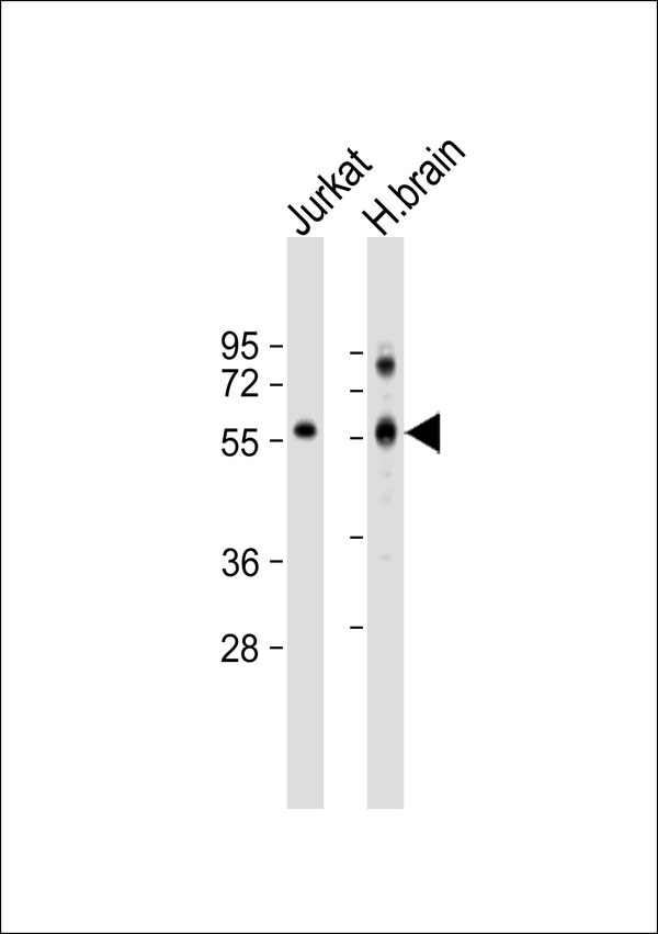 CORO1A / Coronin 1a Antibody - All lanes: Anti-Clipin A Antibody at 1:500 dilution. Lane 1: Jurkat whole cell lysate. Lane 2: human brain lysate Lysates/proteins at 20 ug per lane. Secondary Goat Anti-Rabbit IgG, (H+L), Peroxidase conjugated at 1:10000 dilution. Predicted band size: 51 kDa. Blocking/Dilution buffer: 5% NFDM/TBST.