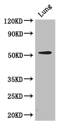 CORO1A / Coronin 1a Antibody - Positive WB detected in:Mouse lung tissue;All lanes: CORO1A antibody at 2.7ug/ml;Secondary;Goat polyclonal to rabbit IgG at 1/50000 dilution;Predicted band size: 52 kDa;Observed band size: 52 kDa;
