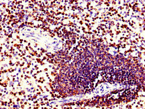 CORO1A / Coronin 1a Antibody - Immunohistochemistry of paraffin-embedded human spleen tissue using CORO1A Antibody at dilution of 1:100