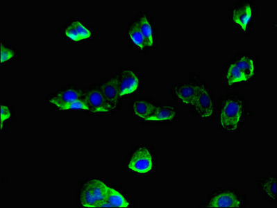CORO1A / Coronin 1a Antibody - Immunofluorescent analysis of HepG2 cells using CORO1A Antibody at dilution of 1:100 and Alexa Fluor 488-congugated AffiniPure Goat Anti-Rabbit IgG(H+L)