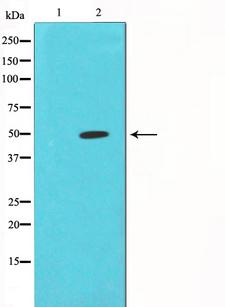 CORO1A / Coronin 1a Antibody - Western blot analysis of extracts of Jurkat cells using CORO1A antibody. The lane on the left is treated with the antigen-specific peptide.