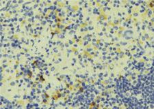 CORO1A / Coronin 1a Antibody - 1:100 staining human lymph tissue by IHC-P. The sample was formaldehyde fixed and a heat mediated antigen retrieval step in citrate buffer was performed. The sample was then blocked and incubated with the antibody for 1.5 hours at 22°C. An HRP conjugated goat anti-rabbit antibody was used as the secondary.