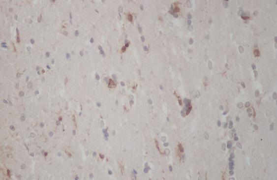 CORO1A / Coronin 1a Antibody - Immunohistochemistry of paraffin-embedded Mouse brain using CORO1A Polyclonal Antibody at dilution of 1:50.
