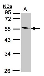CORO1B Antibody - Sample (30 ug whole cell lysate). A:293T. 10% SDS PAGE. CORO1B antibody diluted at 1:1000
