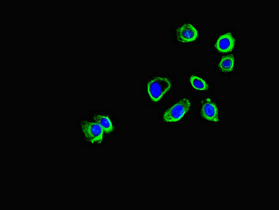 CORO1B Antibody - Immunofluorescent analysis of HepG-2 cells diluted at 1:100 and Alexa Fluor 488-congugated AffiniPure Goat Anti-Rabbit IgG(H+L)