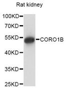 CORO1B Antibody - Western blot analysis of extracts of rat kidney, using CORO1B antibody at 1:1000 dilution. The secondary antibody used was an HRP Goat Anti-Rabbit IgG (H+L) at 1:10000 dilution. Lysates were loaded 25ug per lane and 3% nonfat dry milk in TBST was used for blocking. An ECL Kit was used for detection and the exposure time was 10s.