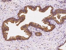 CORO1B Antibody - Immunochemical staining of human CORO1B in human prostate with rabbit polyclonal antibody at 1:2000 dilution, formalin-fixed paraffin embedded sections.