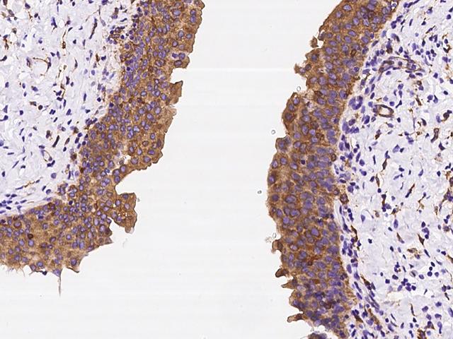 CORO1B Antibody - Immunochemical staining of human CORO1B in human urinary bladder with rabbit polyclonal antibody at 1:2000 dilution, formalin-fixed paraffin embedded sections.