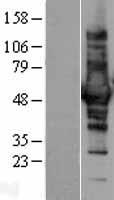 CORO1B Protein - Western validation with an anti-DDK antibody * L: Control HEK293 lysate R: Over-expression lysate