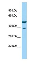 CORO1C Antibody - CORO1C antibody Western Blot of Fetal Brain.  This image was taken for the unconjugated form of this product. Other forms have not been tested.