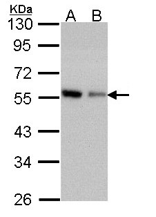 CORO1C Antibody - Sample (30 ug of whole cell lysate). A: A431 . , B: H1299. 10% SDS PAGE. CORO1C antibody diluted at 1:1000.