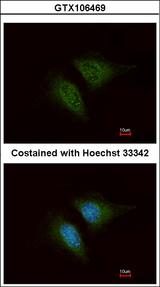 CORO1C Antibody - Immunofluorescence of methanol-fixed HeLa using Coronin 1C antibody at 1:200 dilution.