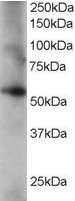 CORO1C Antibody - Antibody staining (0.2 ug/ml) of human lung lysate (RIPA buffer, 35 ug total protein per lane). Primary incubated for 1 hour. Detected by Western blot of chemiluminescence.