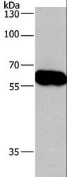 CORO1C Antibody - Western blot analysis of Lovo cell, using CORO1C Polyclonal Antibody at dilution of 1:670.