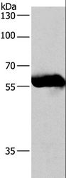 CORO1C Antibody - Western blot analysis of Lovo cell, using CORO1C Polyclonal Antibody at dilution of 1:530.