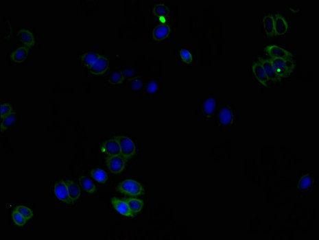 CORO1C Antibody - Immunofluorescent analysis of HepG2 cells using CORO1C Antibody at a dilution of 1:100 and Alexa Fluor 488-congugated AffiniPure Goat Anti-Rabbit IgG(H+L)