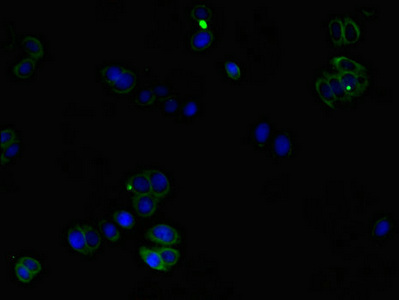 CORO1C Antibody - Immunofluorescent analysis of HepG2 cells using CORO1C Antibody at dilution of 1:100 and Alexa Fluor 488-congugated AffiniPure Goat Anti-Rabbit IgG(H+L)