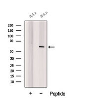 CORO1C Antibody - Western blot analysis of extracts of HeLa cells using CORO1C antibody. The lane on the left was treated with blocking peptide.