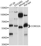 CORO2A Antibody - Western blot analysis of extracts of various cell lines, using CORO2A antibody at 1:1000 dilution. The secondary antibody used was an HRP Goat Anti-Rabbit IgG (H+L) at 1:10000 dilution. Lysates were loaded 25ug per lane and 3% nonfat dry milk in TBST was used for blocking. An ECL Kit was used for detection and the exposure time was 30s.
