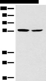 CORO2B Antibody - Western blot analysis of Mouse brain tissue NIH/3T3 cell lysates  using CORO2B Polyclonal Antibody at dilution of 1:1000