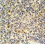 CORO6 Antibody - CORO6 Antibody immunohistochemistry of formalin-fixed and paraffin-embedded human lymph tissue followed by peroxidase-conjugated secondary antibody and DAB staining.
