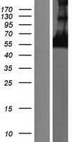 CORO6 Protein - Western validation with an anti-DDK antibody * L: Control HEK293 lysate R: Over-expression lysate