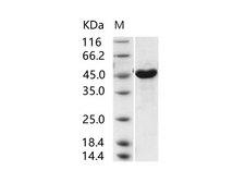 MERS-CoV Nucleoprotein Protein - Recombinant MERS-CoV Nucleoprotein / NP protein (His Tag)
