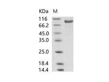 MERS-CoV S1 Protein - Recombinant MERS-CoV Spike/S1 Protein (S1 Subunit, aa 1-725, His Tag)