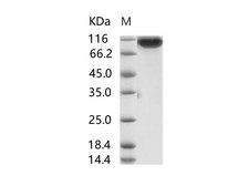 MERS-CoV S1 Protein - Recombinant MERS-CoV Spike/S1 Protein (S1 Subunit, aa 1-725, His Tag)