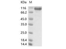 MERS-CoV S1 Protein - Recombinant MERS-CoV Spike/S1 Protein (S1 Subunit, aa 1-725, His Tag), HPLC-verified