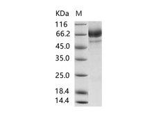 MERS-CoV S2 Protein - Recombinant MERS-CoV Spike/S2 Protein (S2 Subunit, aa 726-1296, His Tag)