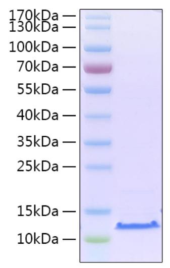 SARS-CoV-2 Envelope  Protein - Recombinant 2019-nCoV envelope Protein was determined by SDS-PAGE with Coomassie Blue, showing a band at 12 kDa.