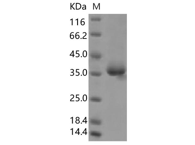 HKU1-CoV S1 Protein - Recombinant SARS-CoV-2 Spike Protein (RBD, His Tag)(W436R)(Active)