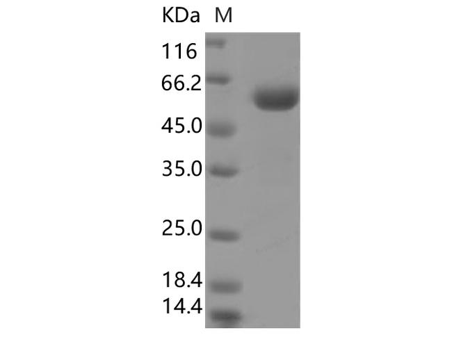 HKU1-CoV S1 Protein - Recombinant SARS-CoV-2 Spike Protein (RBD, mFc Tag)(V367F)