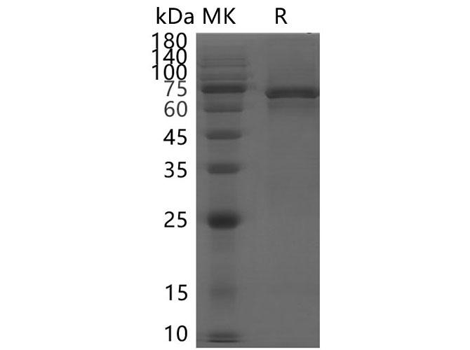 Coronavirus SARS-CoV-2 NSP13 (Helicase) protein Protein - Recombinant SARS-CoV-2 NSP13 protein