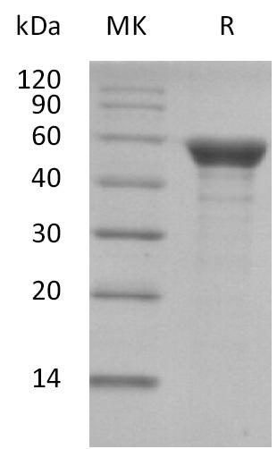 SARS-CoV-2 Nucleoprotein Protein