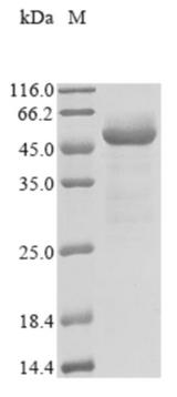 SARS-CoV-2 Nucleoprotein Protein - (Tris-Glycine gel) Discontinuous SDS-PAGE (reduced) with 5% enrichment gel and 15% separation gel.