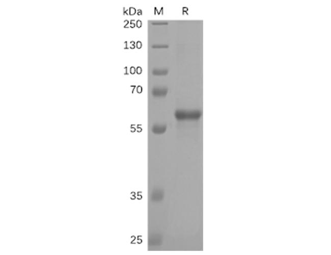 SARS-CoV-2 Protein - 2.ELISA plate pre-coated by 2 µg/ml (100 µl/well) S-RBD, mFc-His tagged protein (PKSV030276) can bind Human ACE2, hFc Tagged protein (PKSR030492) in a linear range of 0.488-49.83 ng/ml.Recombinant SARS-CoV-2 (2019-nCoV) S protein RBD (C-mFc-6His tag)(Active)