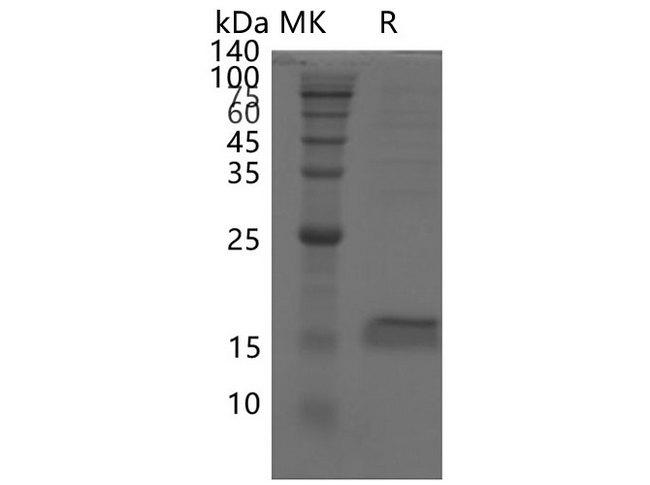 Coronavirus SARS-CoV-2 ORF7a Protein Protein - Recombinant SARS-CoV-2 ORF7a protein