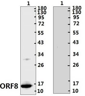 Coronavirus SARS-CoV-2 ORF8 Protein Protein