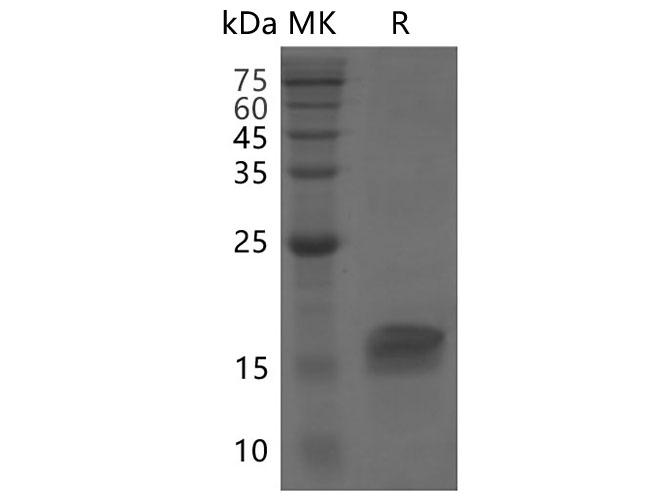 Coronavirus SARS-CoV-2 ORF8 Protein Protein - Recombinant SARS-CoV-2 ORF8 protein